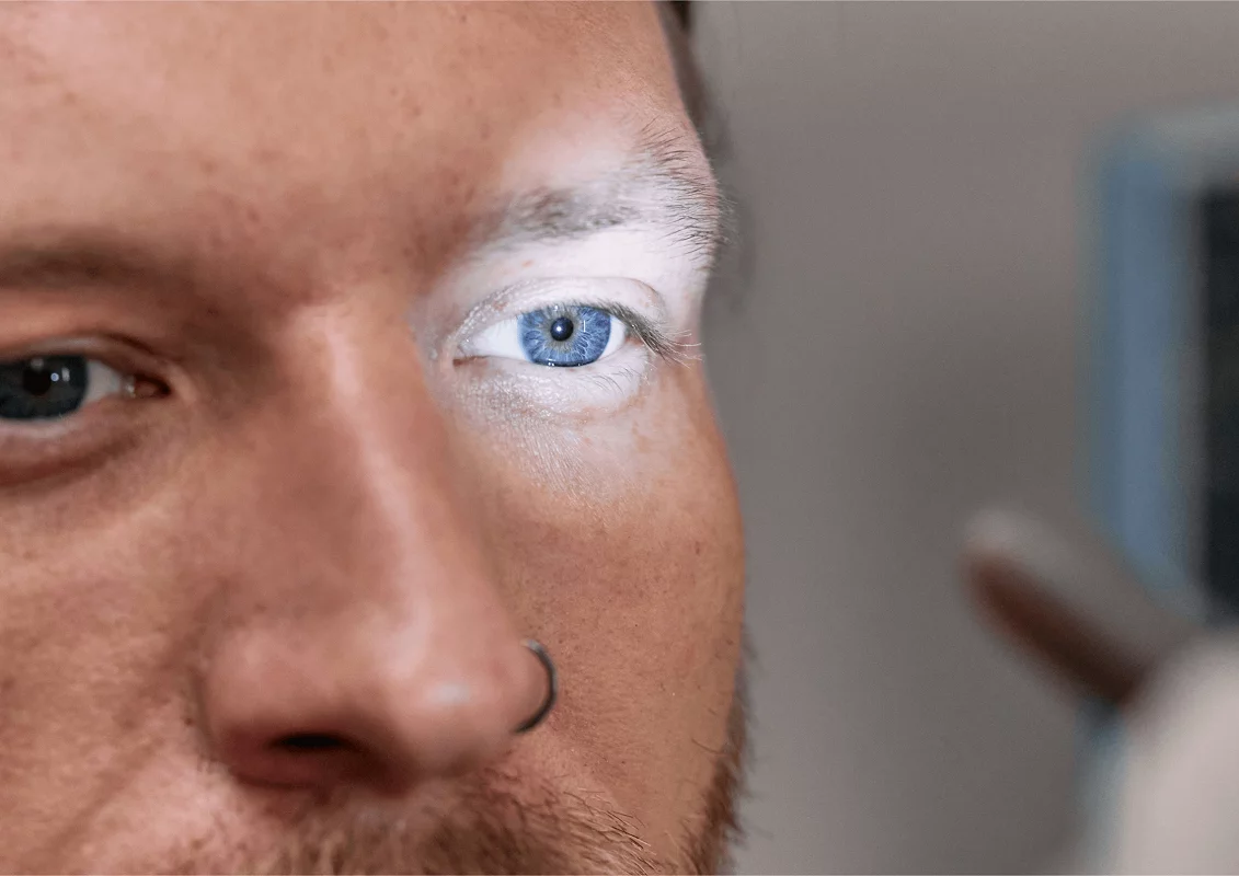 Olhar Prime na Mídia | Maio Verde - Mês de Prevenção e Combate ao Glaucoma
